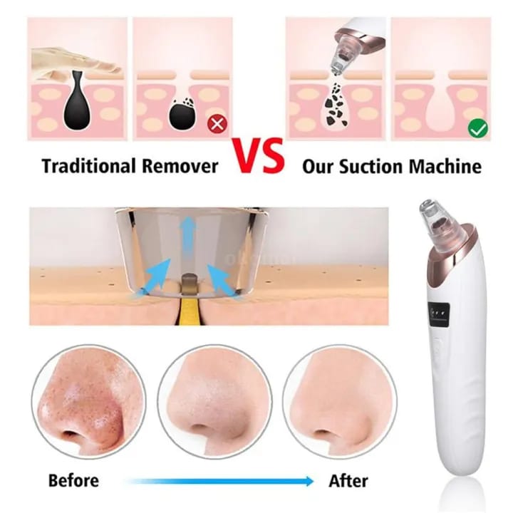 Face Vacuum Suction Blackhead Remover Pore Cleaner | Electric Deep Cleansing Tool for Nose & amp Face